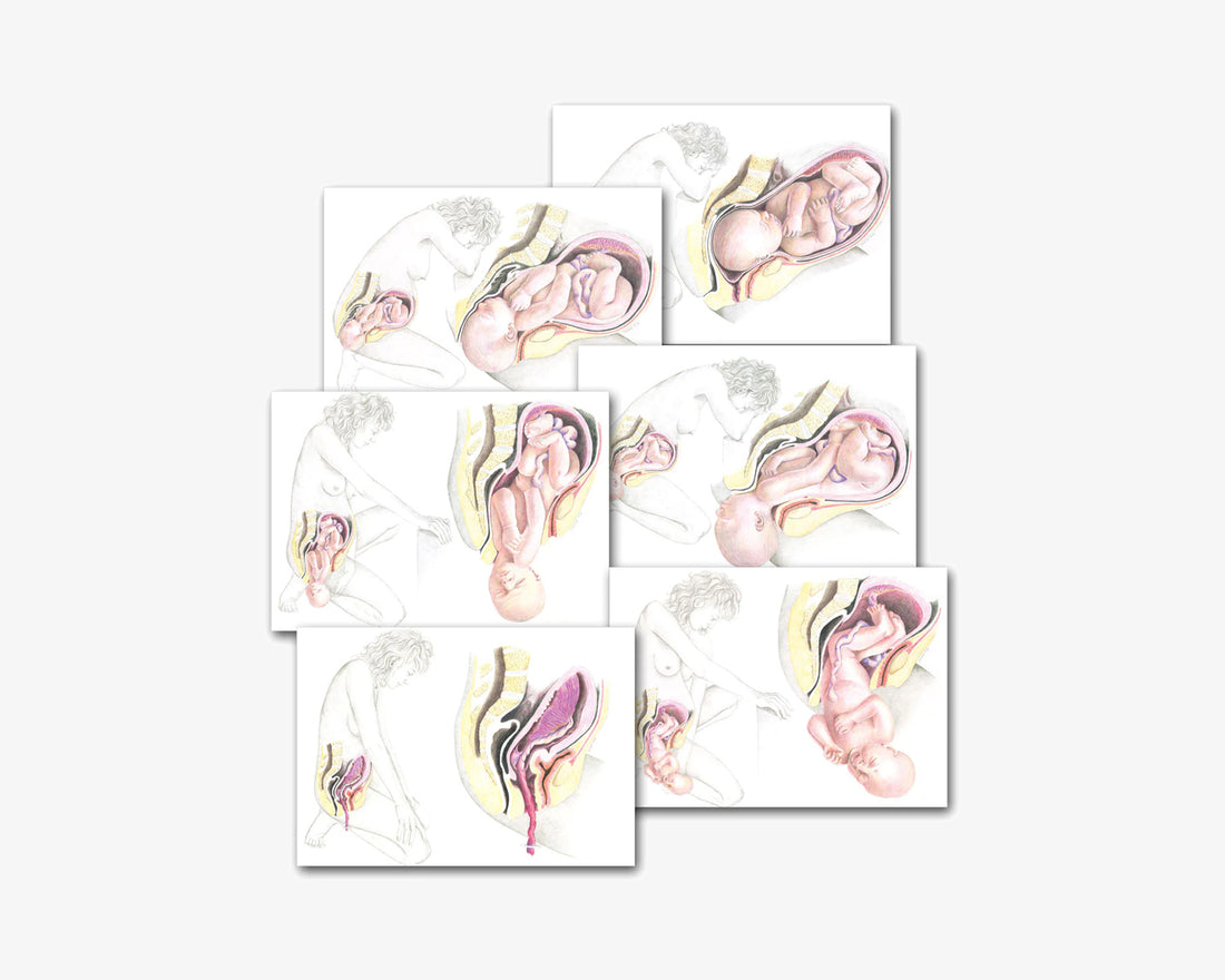 Posterset: Aufrechte Entbindung