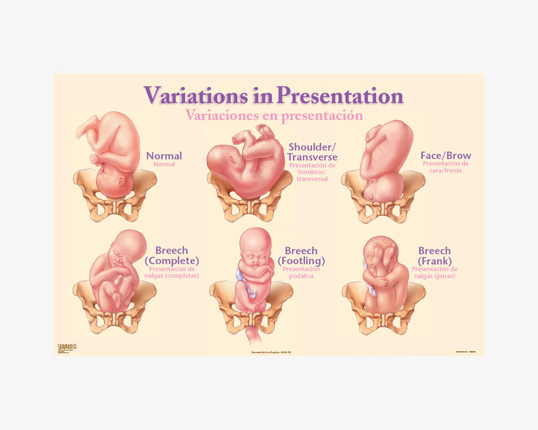 Poster: Fetale Einstellungen (englisch/spanisch)