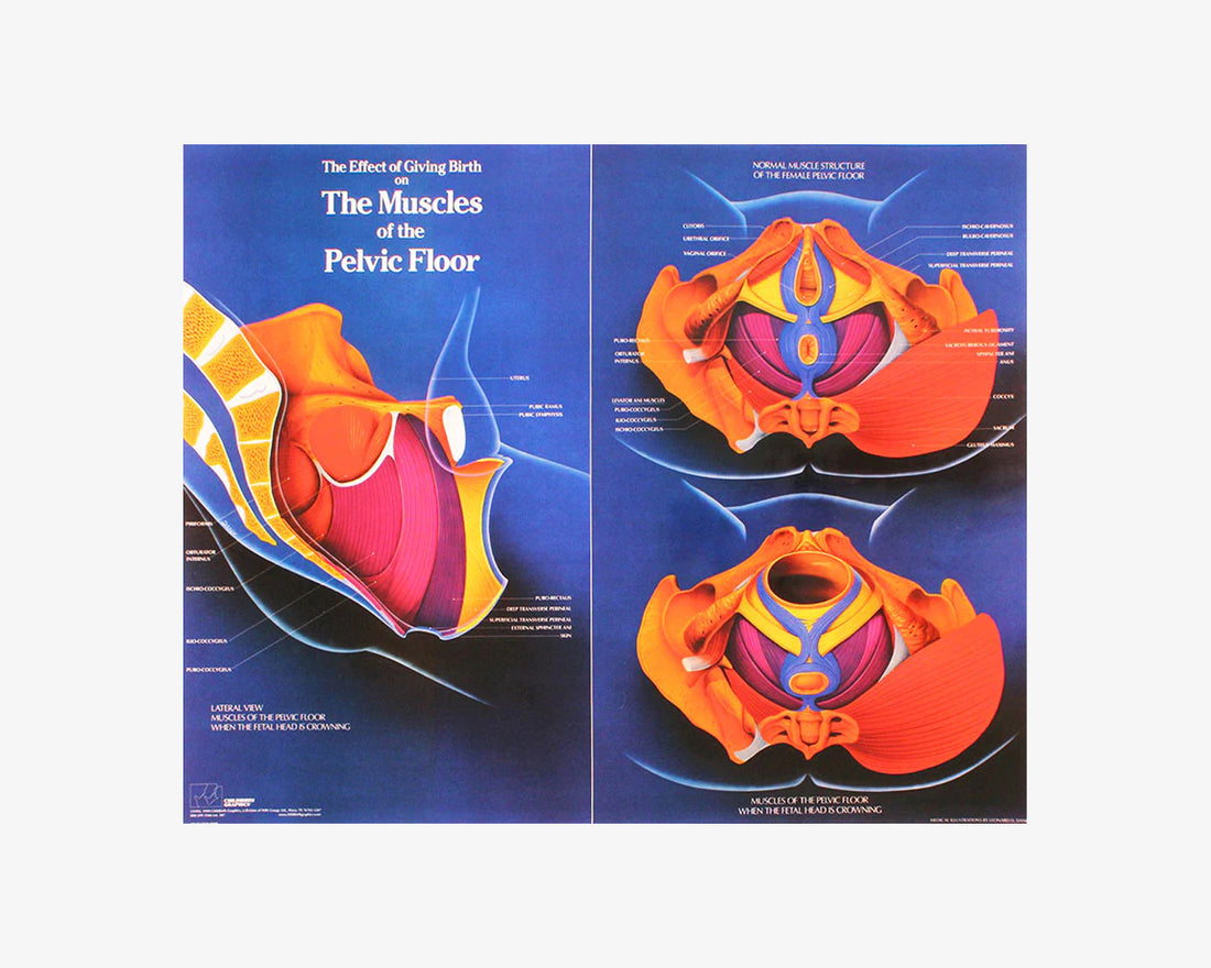 Poster: Geburtsauswirkungen (englisch)