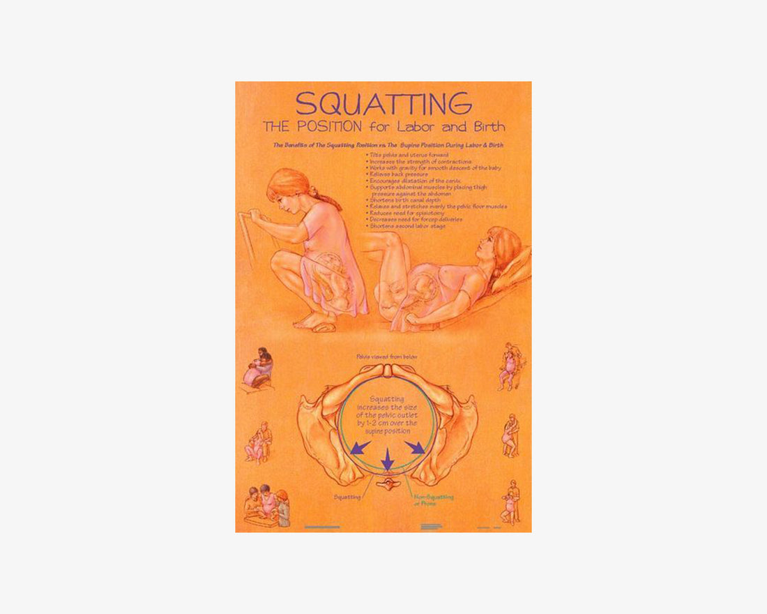 Poster: Gebärposition Hocke (englisch)
