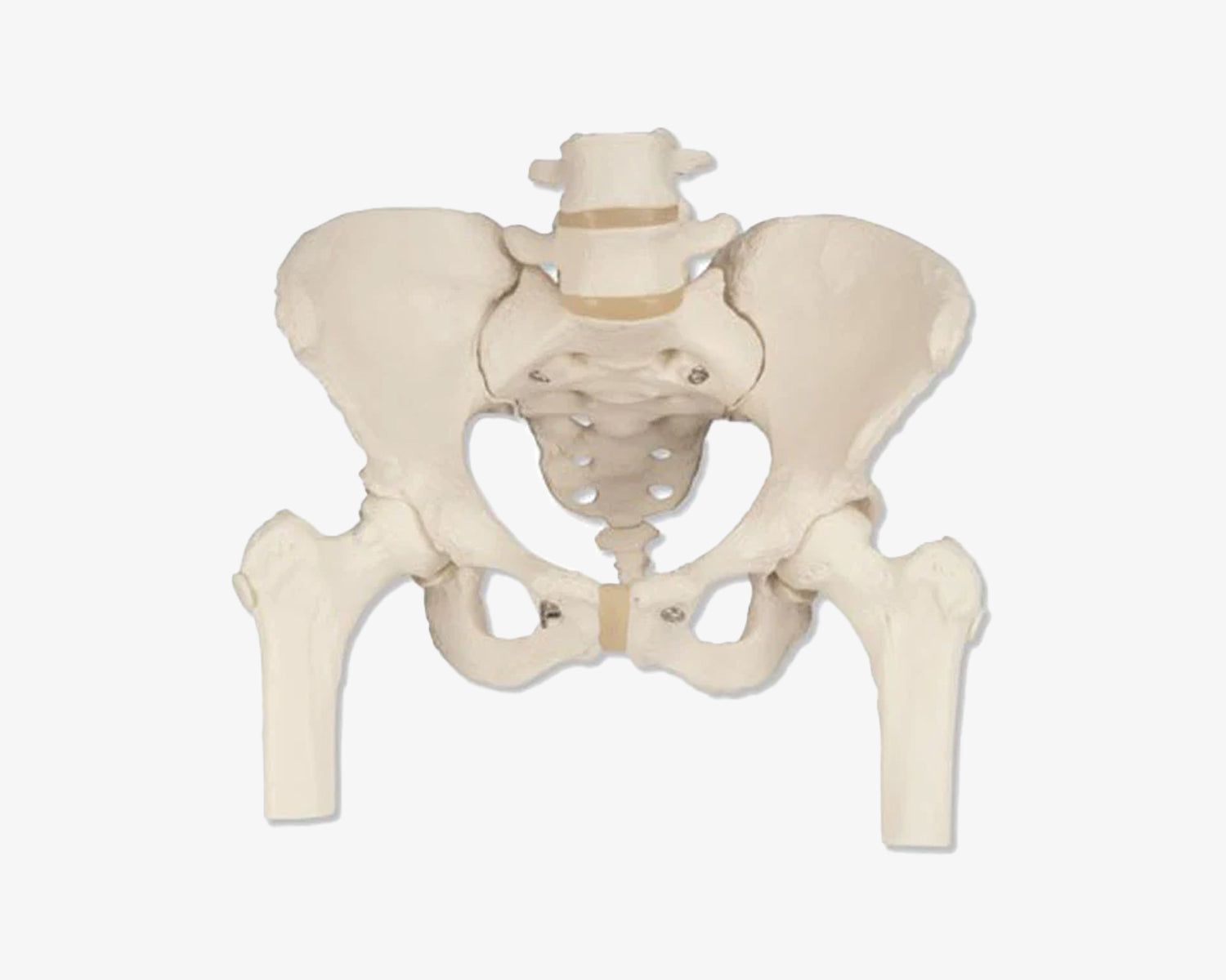 Weibliches Beckenskelett mit Oberschenkelstümpfen